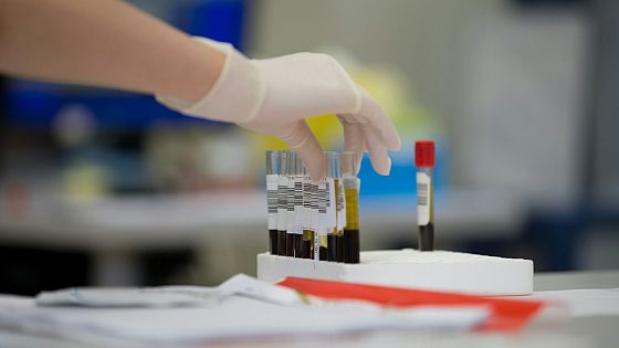 L’oro invisibile: la lunga corsa per creare il sangue più raro del mondo